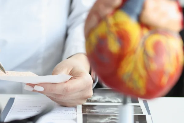 ¿Qué médico trata angina de pecho?